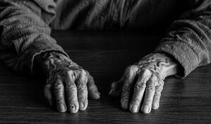 Casi 30,000 millones de euros: la factura sanitaria y social anual del p&aacute;rkinson en Europa