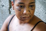 Sobrevivió a 26 estocadas y ahora lucha por sanar las heridas físicas y emocionales Sobrevivió a 26 estocadas y ahora lucha por sanar las heridas físicas y emocionales