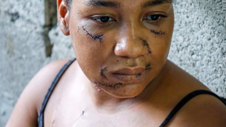 Sobrevivir a 26 puñaladas: las heridas que cura Nayely Sobrevivir a 26 puñaladas: las heridas que cura Nayely