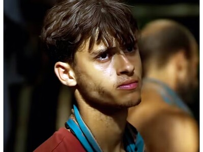 Perdió pierna durante Survivor en RD, y demanda por US100 millones