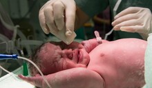 Parto vaginal o ces&aacute;rea: beneficios y riesgos de las diferentes formas de dar a luz