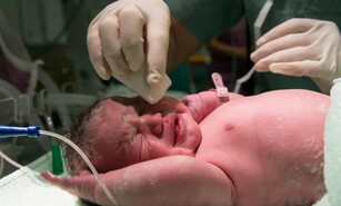 Parto vaginal o ces&aacute;rea: beneficios y riesgos de las diferentes formas de dar a luz