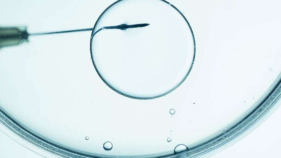 Padres demandan a clínica de fertilidad en EE. UU. al descubrir que su hija es de otro hombre Padres demandan a clínica de fertilidad en EE. UU. al descubrir que su hija es de otro hombre