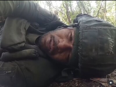 Me explotaron los pies: cómo está el dominicano herido en guerra rusa