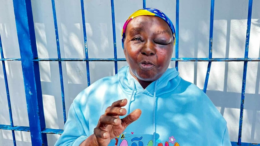 Mujer de 63 a&ntilde;os denuncia robo y brutal agresi&oacute;n dentro de su vivienda en Barahona
