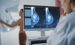Programa de detecci&oacute;n de c&aacute;ncer de mama del Gobierno registra 113 casos y cinco muertas desde 2021