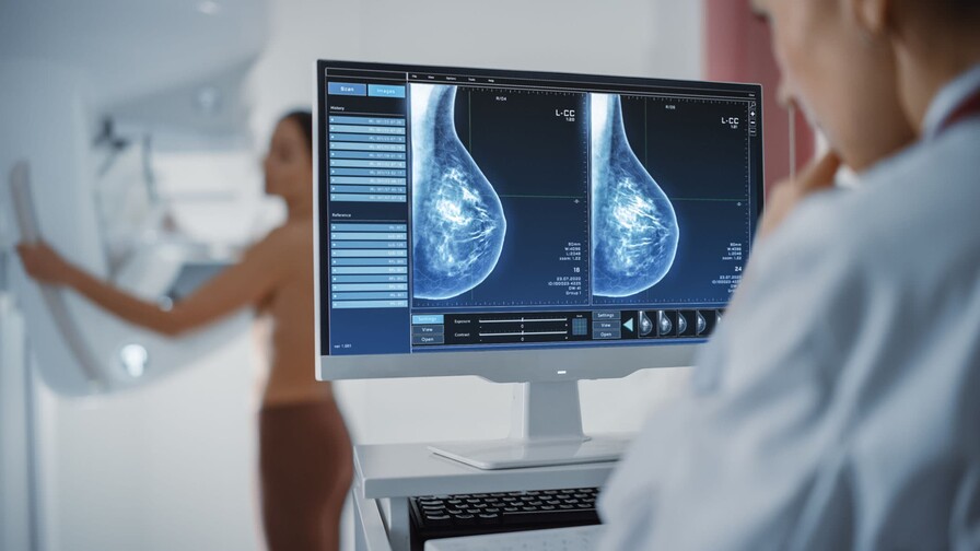 Programa de detección de cáncer de mama del Gobierno registra 113 casos y cinco muertas desde 2021 Programa de detección de cáncer de mama del Gobierno registra 113 casos y cinco muertas desde 2021
