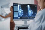 Mast&oacute;loga: Son m&aacute;s las mujeres que se curan del c&aacute;ncer de mama