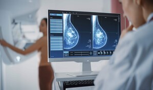 Mast&oacute;loga: Son m&aacute;s las mujeres que se curan del c&aacute;ncer de mama