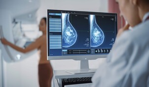Mast&oacute;loga: Son m&aacute;s las mujeres que se curan del c&aacute;ncer de mama