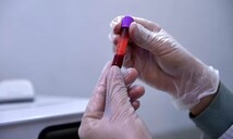 Un estudio valida el uso de muestras de sangre capilar para el control antidopaje