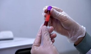 Un estudio valida el uso de muestras de sangre capilar para el control antidopaje