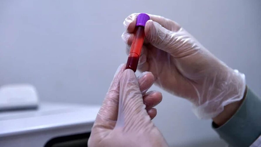 Un estudio valida el uso de muestras de sangre capilar para el control antidopaje