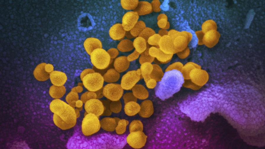 Niños con mal inflamatorio tuvieron COVID-19 pero leve