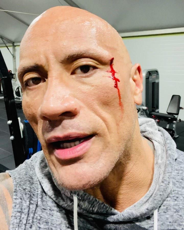Dwayne The Rock Johnson sufre un pequeño accidente en el rostro mientras hacía ejercicios  