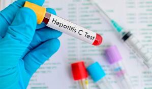 La hepatitis C, una enfermedad curable que requiere atención