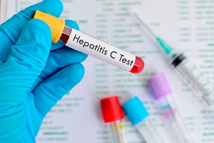 La hepatitis C, una enfermedad curable que requiere atención