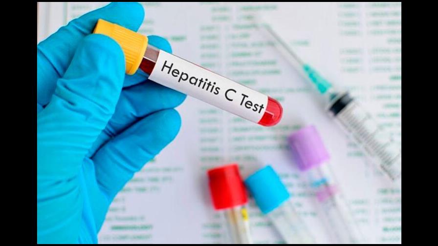 La hepatitis C, una enfermedad curable que requiere atención