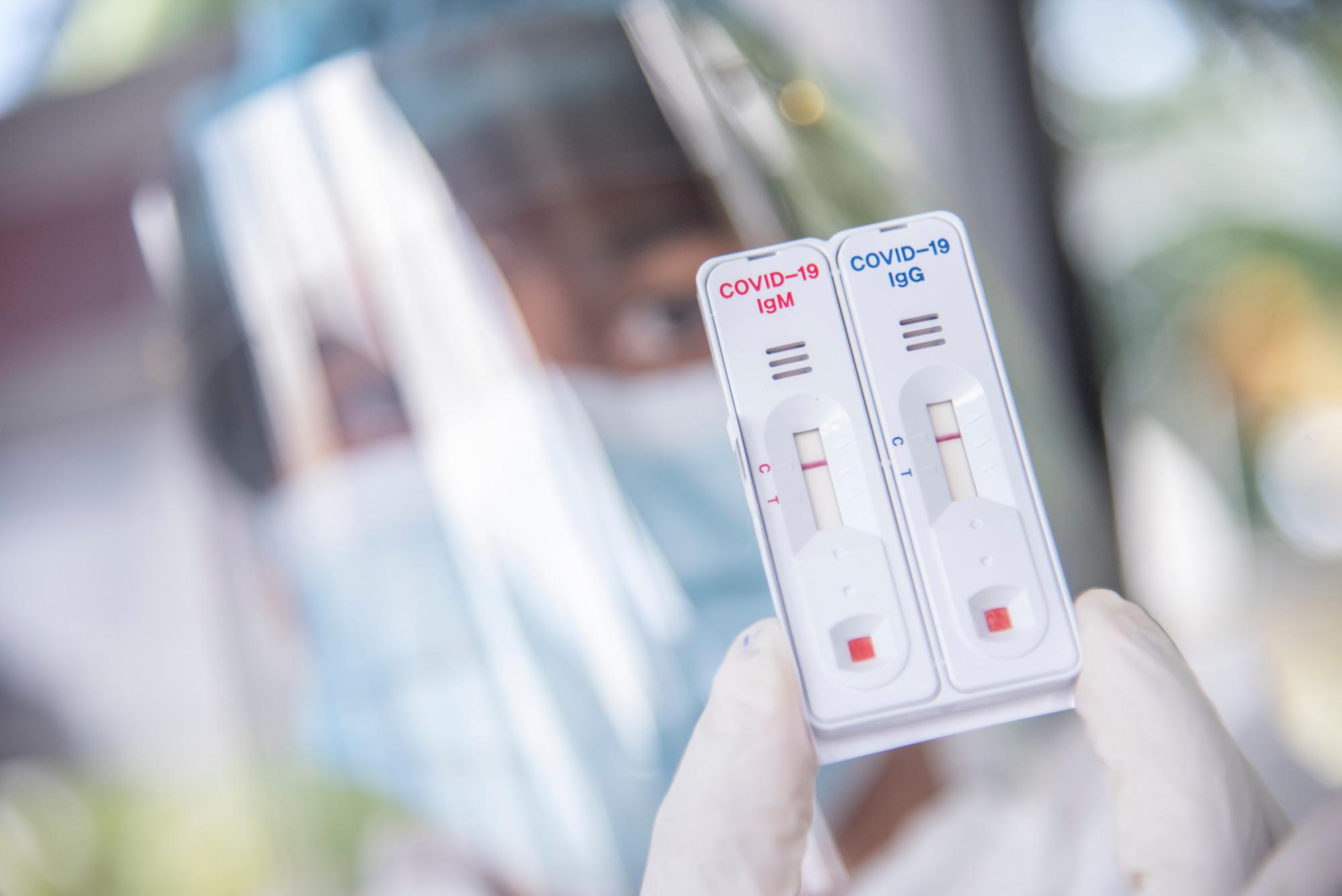 Un miembro del equipo de Salud Pública muestra una prueba en la unidad de pruebas rápidas. Se realizaron pruebas rápidas a aquellos pacientes que califiquen con el protocolo, con fines de determinar si califican para la realización de una PCR.