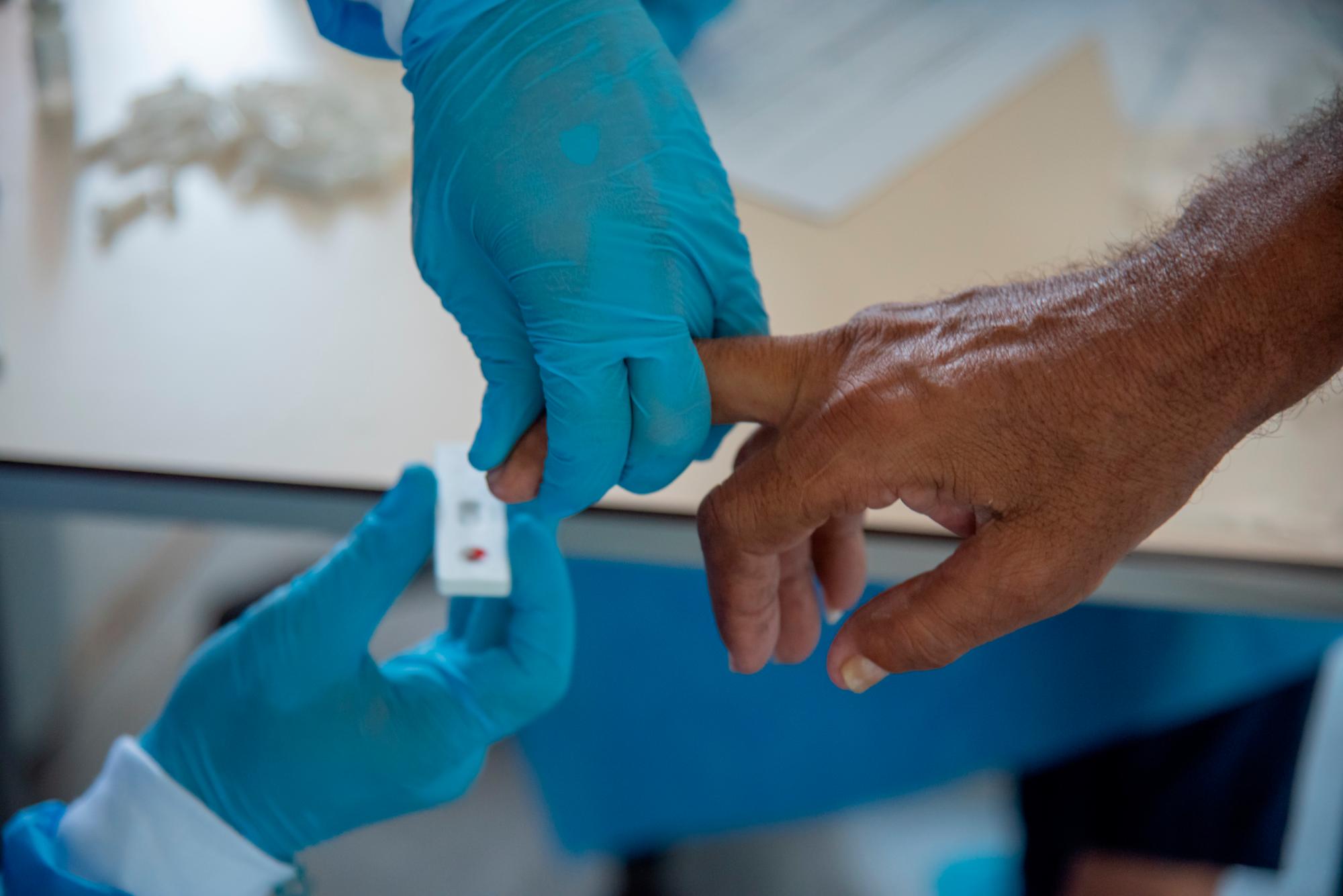 El procedimiento para la realización de pruebas consiste en realizar una muestra rápida y si el caso lo amerita una PCR.