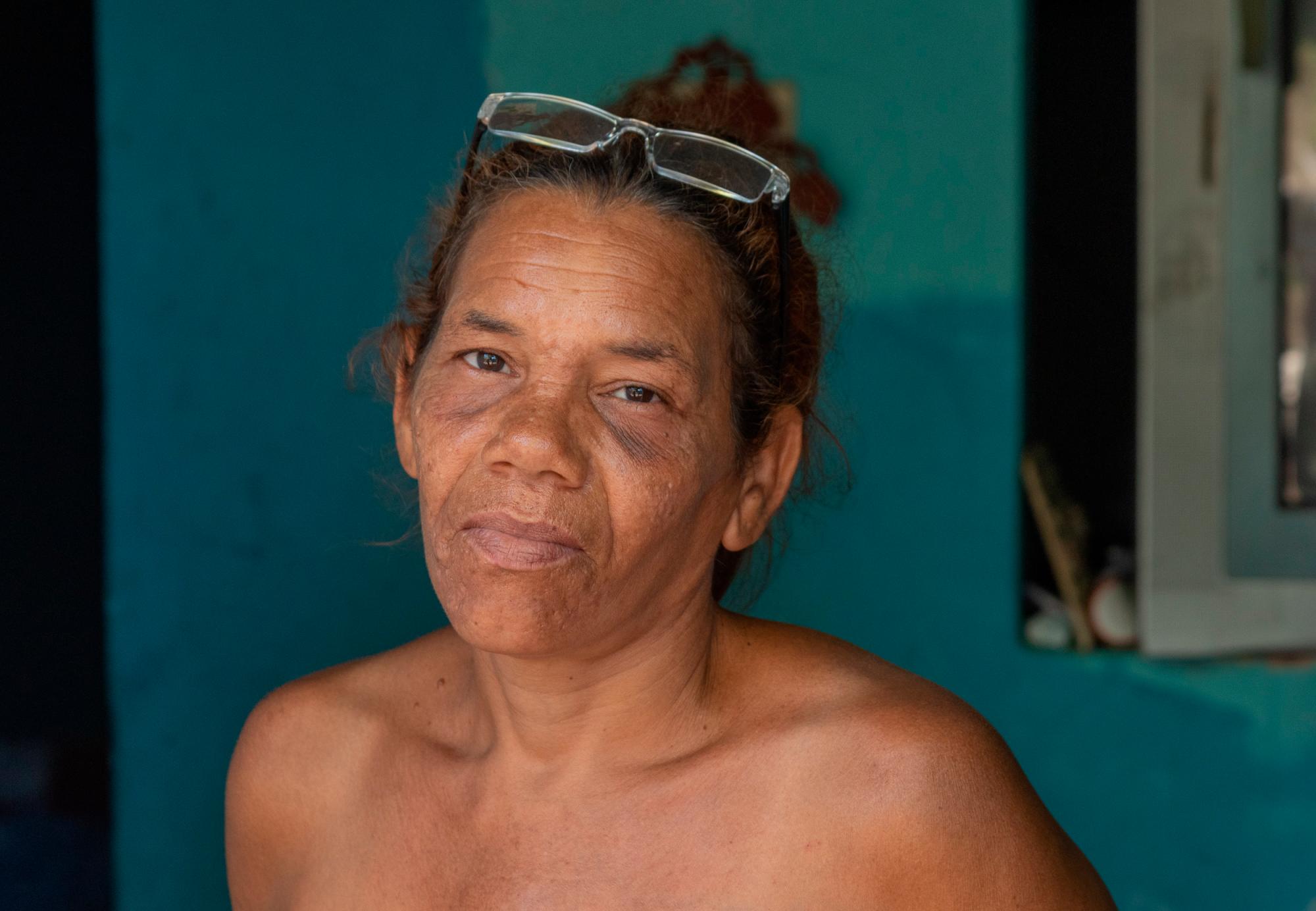 María Rodríguez, una de las afectadas, que dice no olvida el suceso de febrero de 2016.  