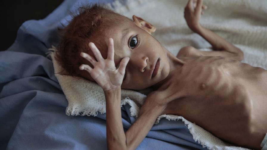 Yemen: Usan privación de alimentos como arma de guerra
