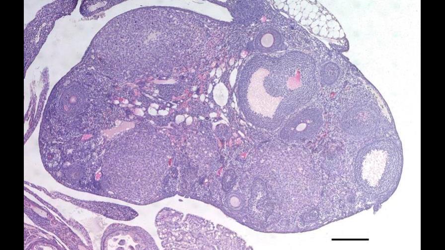 Identifican 290 variantes génicas ligadas a la vida reproductiva de la mujer