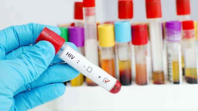 Un tratamiento elimina el VIH del genoma de animales vivos