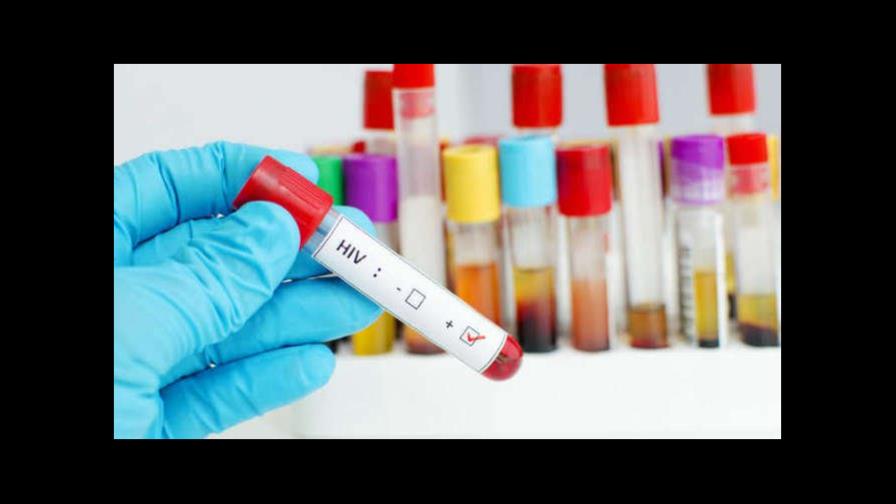 Un tratamiento elimina el VIH del genoma de animales vivos