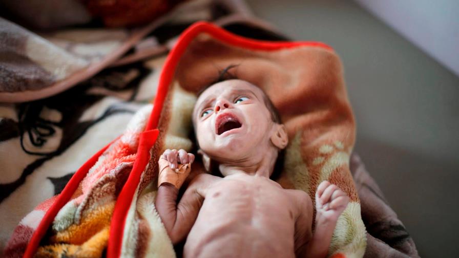 Comer hojas hervidas para sobrevivir en un Yemen que se muere de hambre