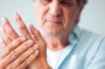Artritis reumatoide, una   de las enfermedades más incapacitantes en el mundo Artritis reumatoide, una   de las enfermedades más incapacitantes en el mundo