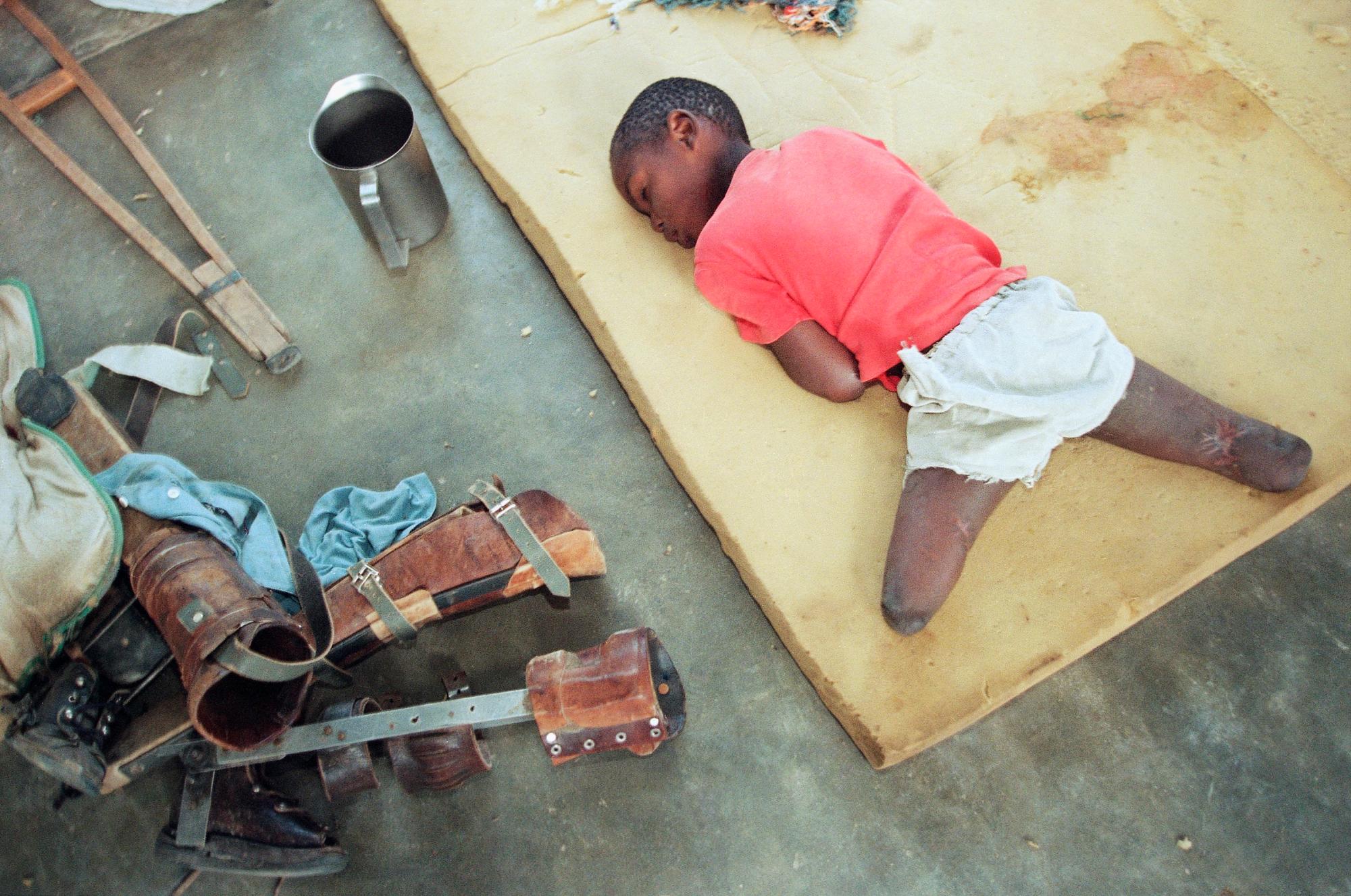 Una foto de archivo del 9 de junio de 1994, se observa a un joven huérfano, sus piernas amputadas por debajo de la rodilla, descansa sobre un cojín de espuma cerca de sus extremidades artificiales en un orfanato en Nyanza, a unas 35 millas al suroeste de la capital Kigali, Ruanda. 