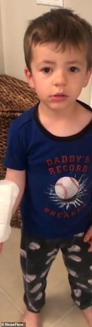 Niño usa toalla sanitaria de su hermana para cubrir herida en su brazo