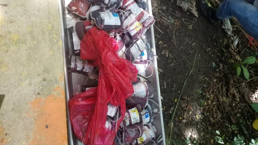 Policía dice fundas con extremidades humanas tienen el logo del Salvador B. Gautier Policía dice fundas con extremidades humanas tienen el logo del Salvador B. Gautier