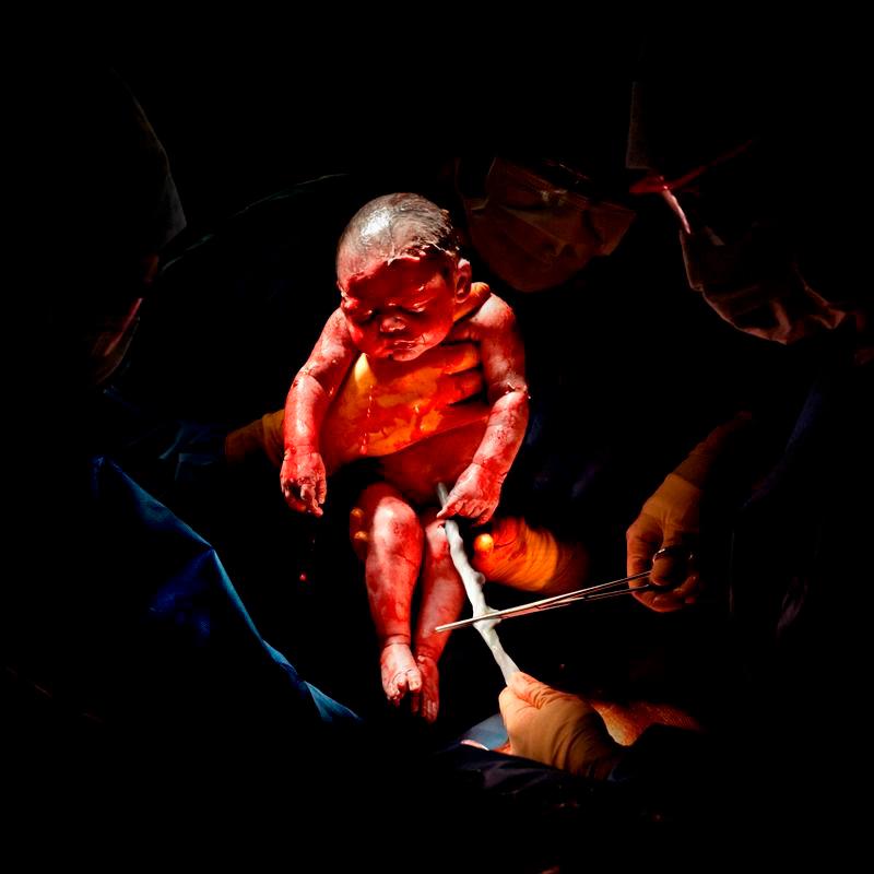 CESAR # 2 - Liza. Nació el 26 de febrero de 2013 a las 8:45 a.m. 3,2 kg, 3 segundos de vida. 