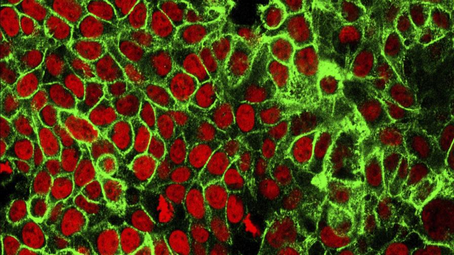 Expertos aconsejan exámenes de cáncer de colon desde 45 años