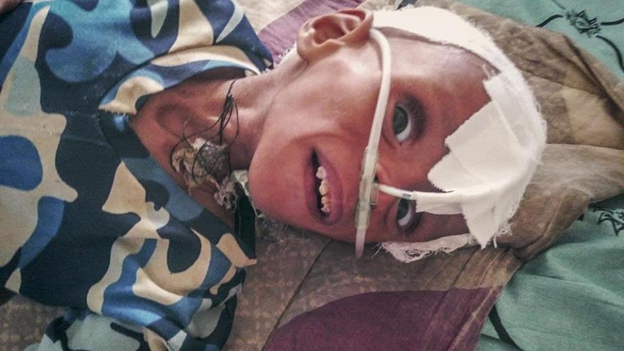 Una hambruna mortal golpea a la asediada Tigray, en Etiopía