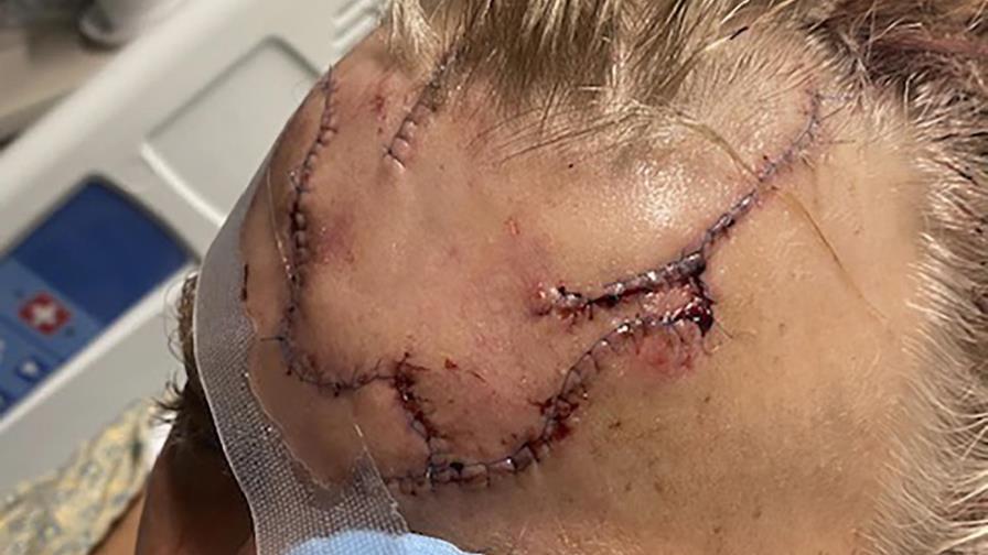 Hombre sobrevive a ataque de oso en zona remota de Alaska