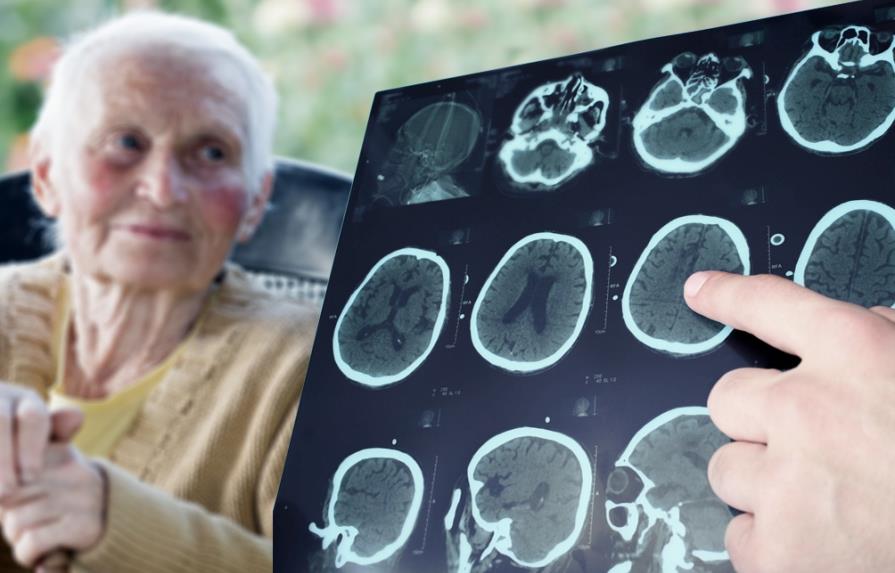 Guía de consejos para evitar la aparición de demencia en la edad avanzada 
