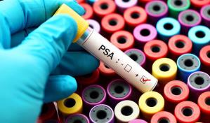 ¿Sabías que el cáncer de próstata no crece tan rápido como la mayoría?