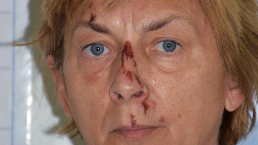 Policía croata busca ayudar a mujer que no recuerda quién es