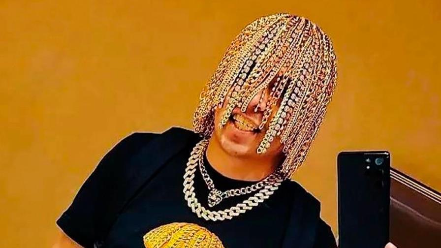 Rapero se implanta cadenas de oro como cabello