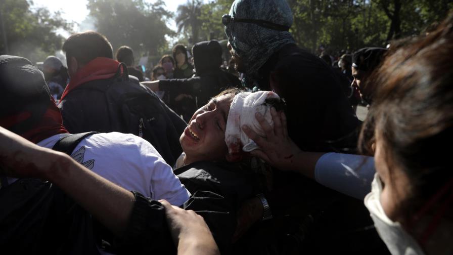 Al menos 230 chilenos cegados por disparos de la policía