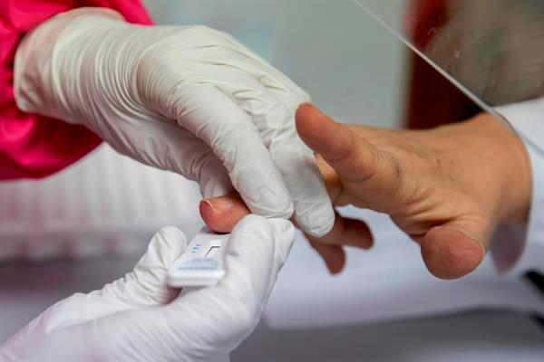 África necesita 15 millones de test de coronavirus en los próximos meses