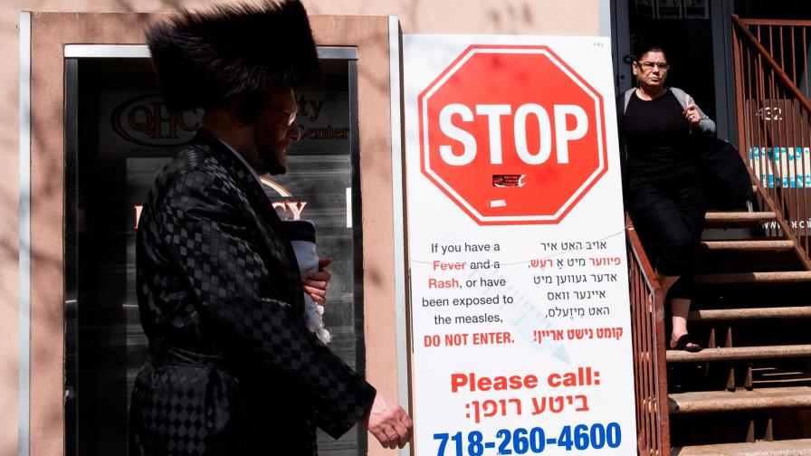 Cuarentena por sarampión alcanza a más de 650 personas en Los Ángeles