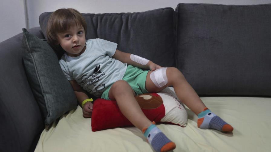 Niños en Beirut sufren trauma tras la potente explosión Niños en Beirut sufren trauma tras la potente explosión