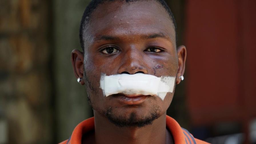 Haití se alista para nuevas protestas contra el gobierno Haití se alista para nuevas protestas contra el gobierno