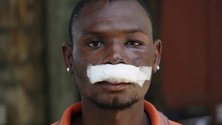 Piden a gritos renuncia de presidente haitiano Jovenel Moïse Piden a gritos renuncia de presidente haitiano Jovenel Moïse