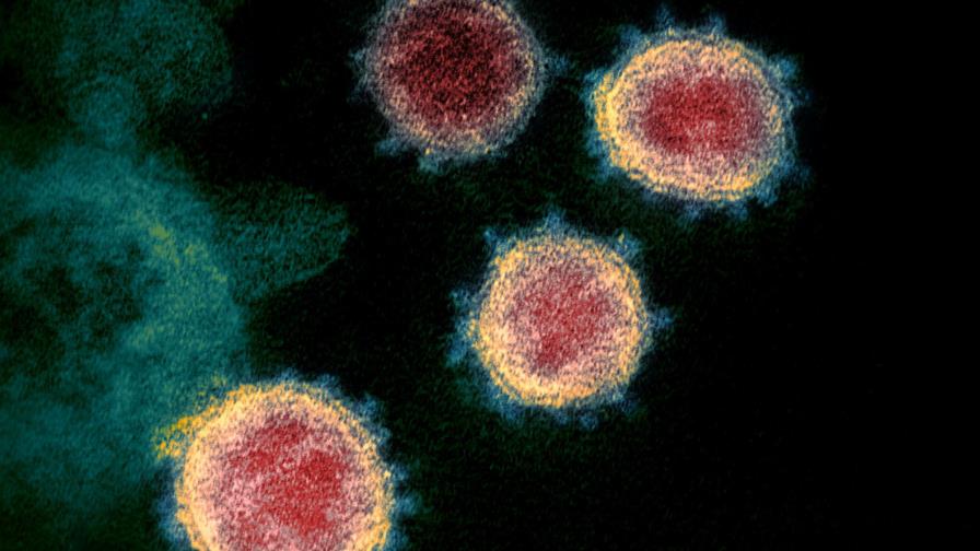 Japón: Paciente de COVID recibe tejido pulmonar de donantes