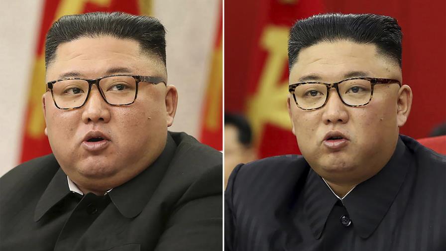Kim Jong-Un adelgaza y desata especulaciones sobre su salud Kim Jong-Un adelgaza y desata especulaciones sobre su salud